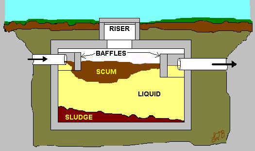 What Do You Need to Know About Septic Tank Bacteria